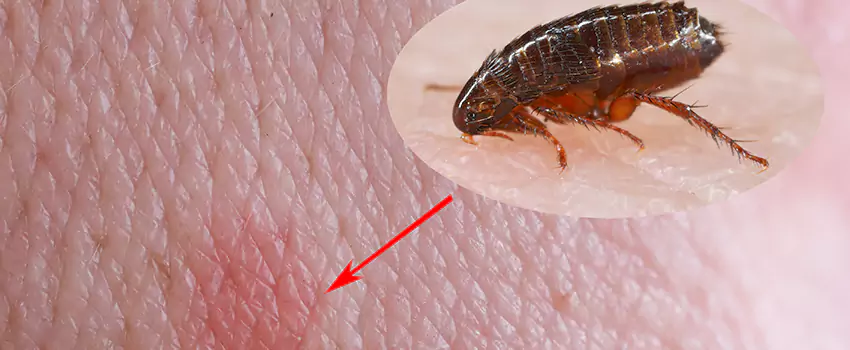 Flea Control for Humans Rancho Cucamonga, CA